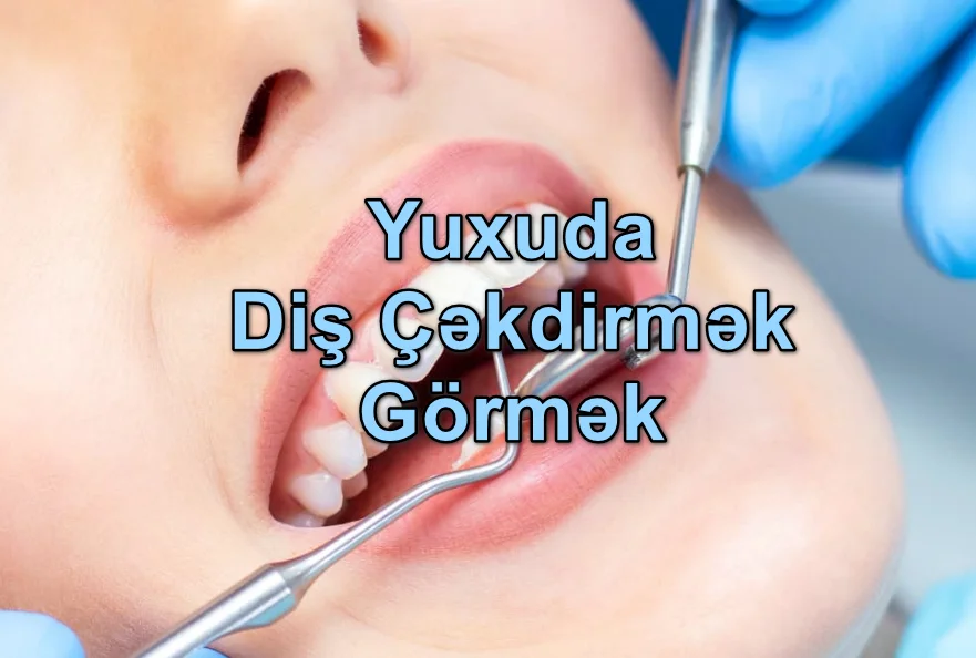 Yuxuda Diş Çəkdirmək Görmək Nə Deməkdir? Yozması Nədir?