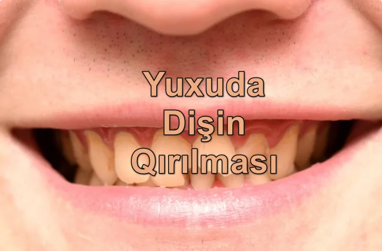 Yuxuda Dişin Qırılması Nə Deməkdir? Yozması Nədir