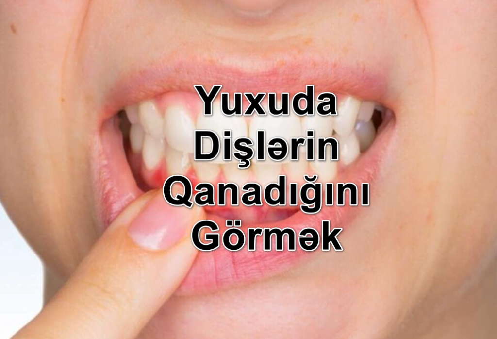 Yuxuda Dişlərin Qanadığını Görmək